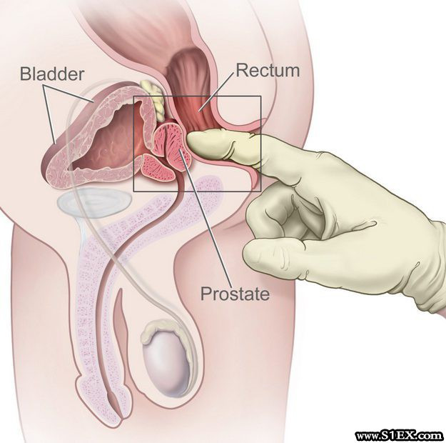 Prosztatamasszázs masszőrnél vagy kurvánál