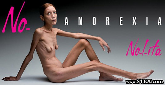 anorexia